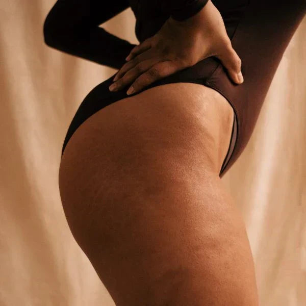 Alles rundum Scheideninfektion